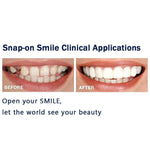 Load image into Gallery viewer, Magic Smile Teeth Brace
