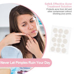 Load image into Gallery viewer, Pimples Sticker M Nexcare Waterproof &amp; Bacteria Free Patches
