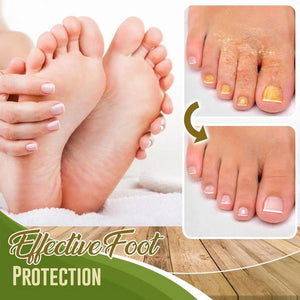 Foot Deodorant and Dehumidification Spray