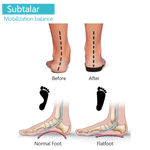 Load image into Gallery viewer, Elastic toe separator, 1 pair
