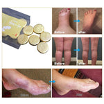 Load image into Gallery viewer, Anti-Swelling &amp; Fungal Foot SPA
