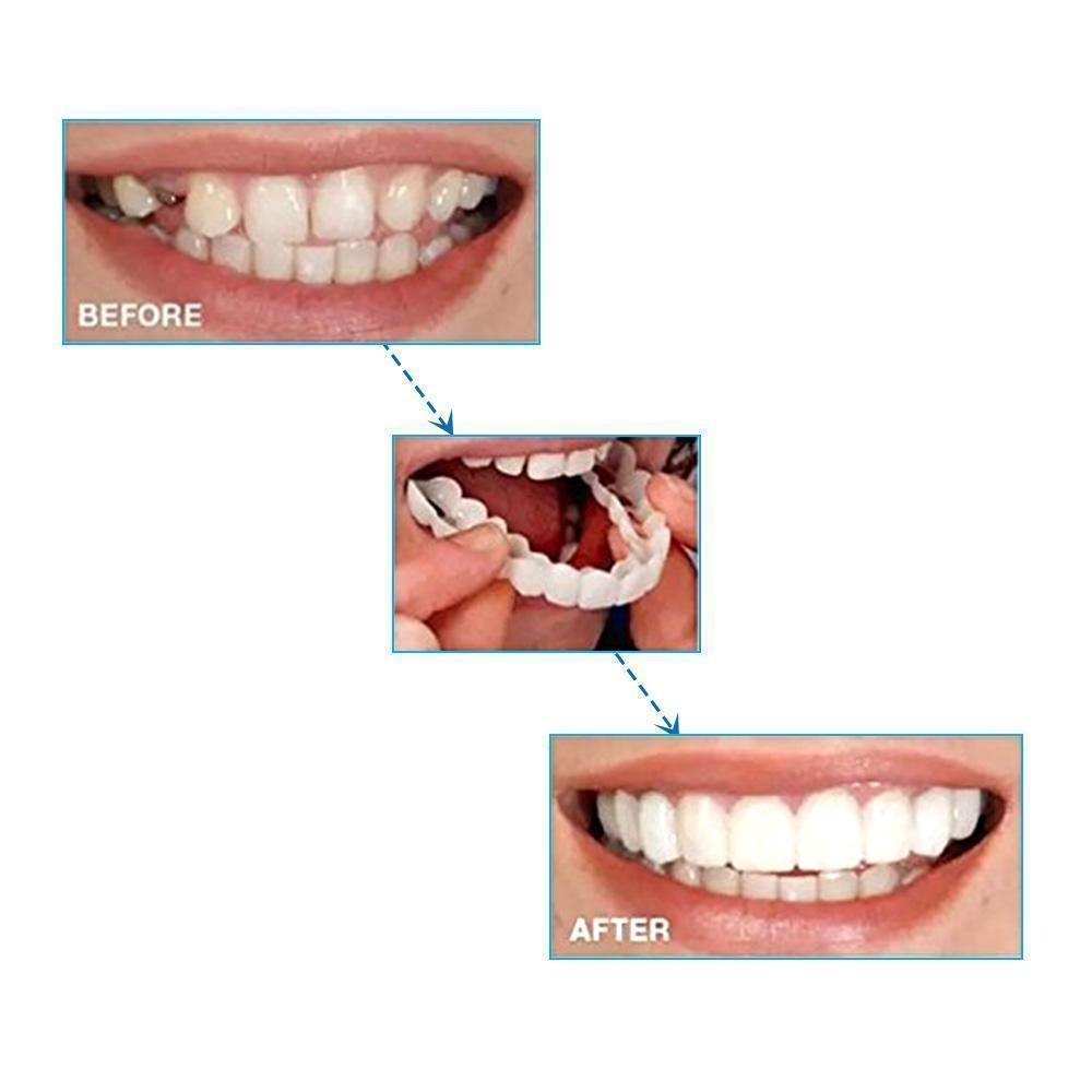 Magic Smile Teeth Brace