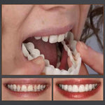 Load image into Gallery viewer, Magic Smile Teeth Brace
