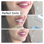 Load image into Gallery viewer, Magic Smile Teeth Brace
